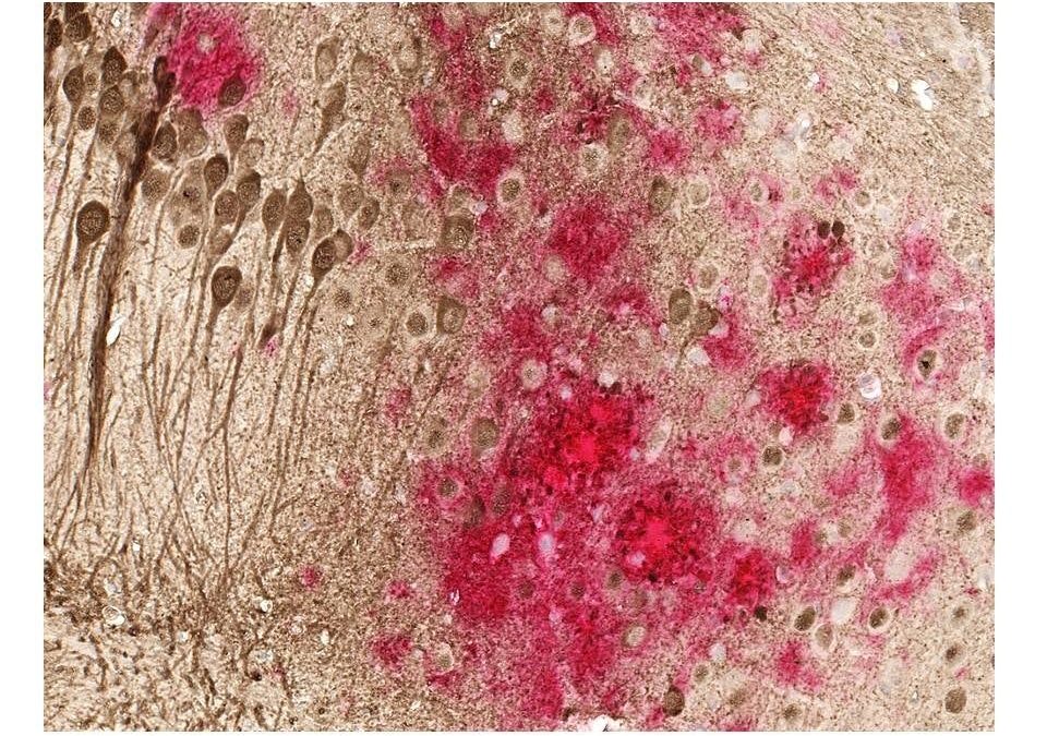 Promising DNA vaccine for Alzheimer’s moves closer to human trials (New Atlas)